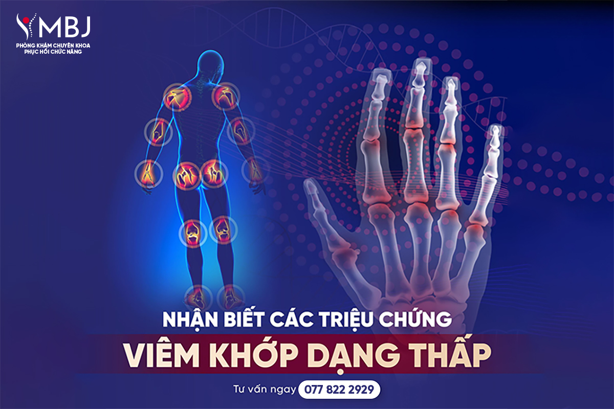 Nhận biết các triệu chứng của Viêm khớp dạng thấp