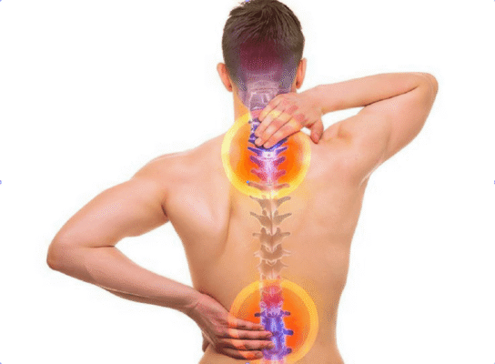 điều trị gai cột sống