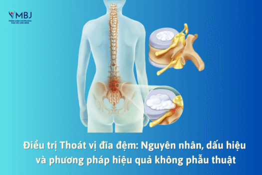 điều trị thoát vị đĩa đệm