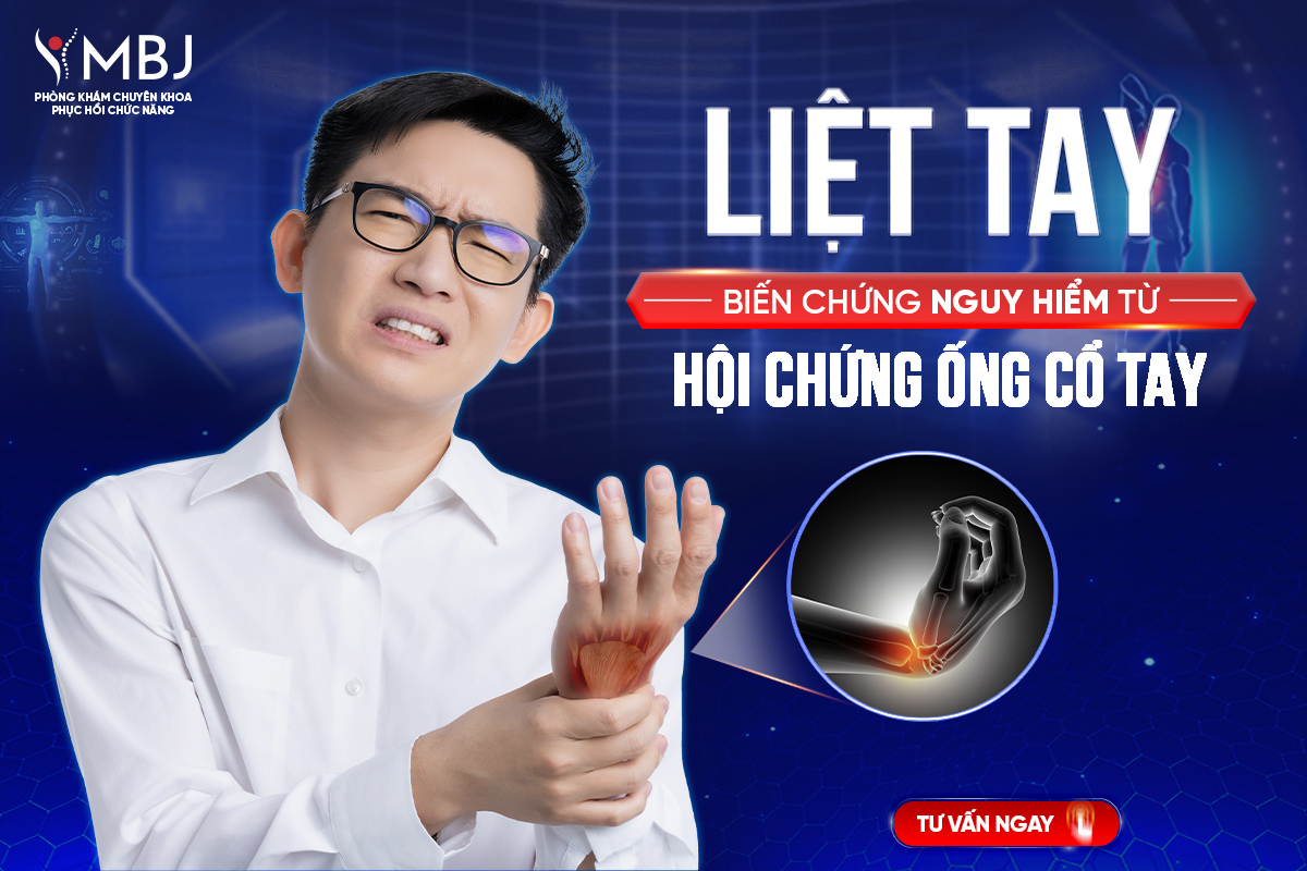 Biến chứng liệt tay từ hội chứng ống cổ tay