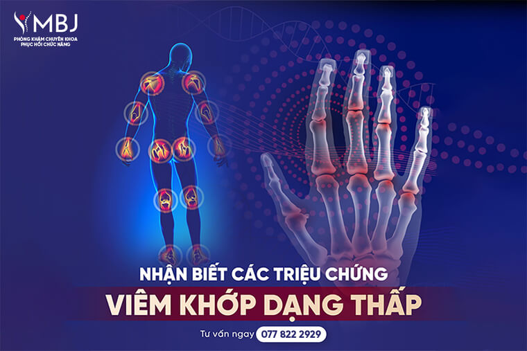 dấu hiệu nhận biết viêm khớp dạng thấp