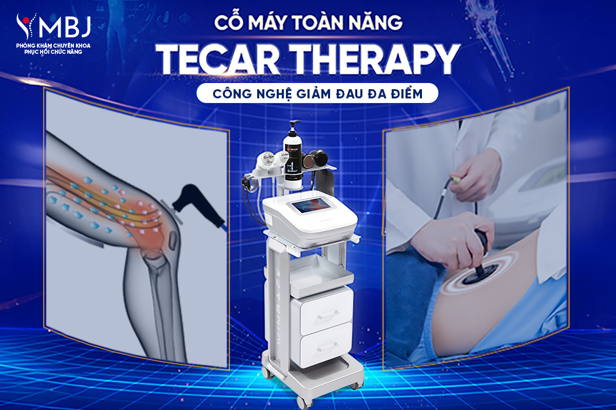 Giảm đau đa điểm Tecar Therapy 
