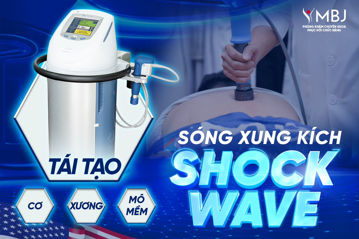 Sóng xung kích Shockwave