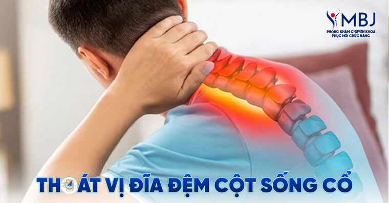 thoát vị đĩa đệm cột sống cổ