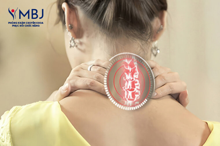 điều trị Thoát vị đĩa đệm cột sống cổ