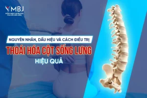điều trị thoái hóa cột sống lưng