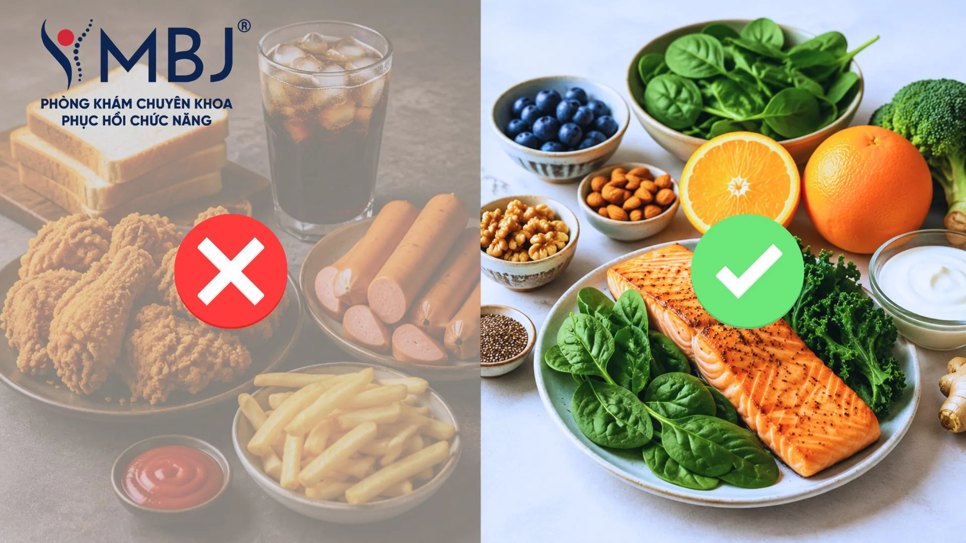 Thực phẩm nên kiêng và nên ăn khi bị thoát vị đĩa đệm