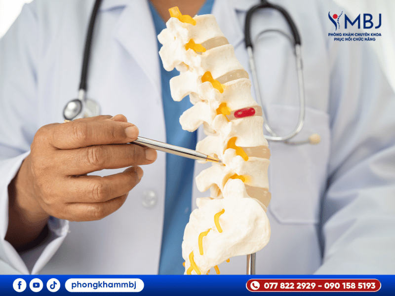 Bệnh lý thoát vị đĩa đệm