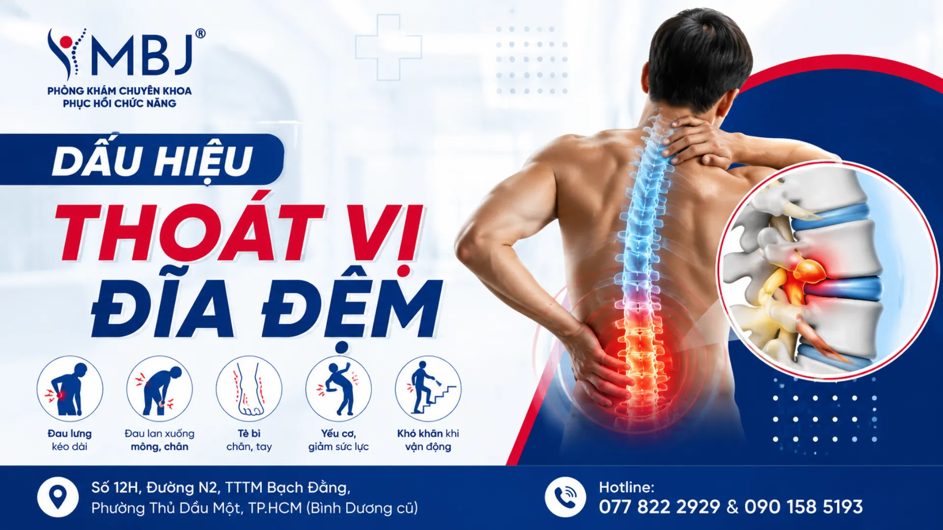 Dấu hiệu thoát vị đĩa đệm theo vị trí và khi nào nguy hiểm