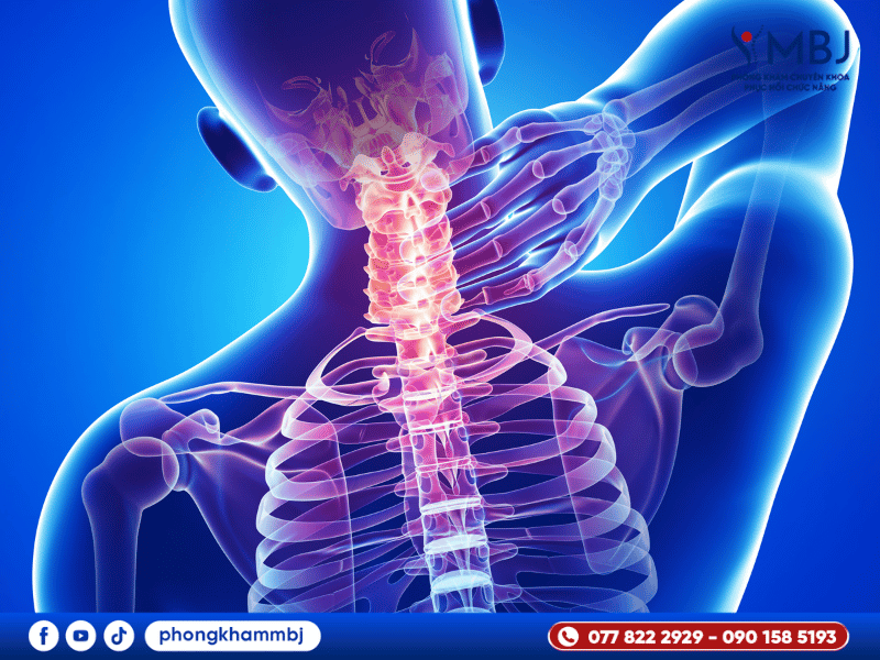triệu chứng đau cổ vai gáy