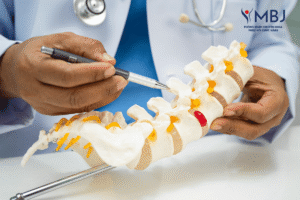 biểu hiện thoát vị đĩa đệm