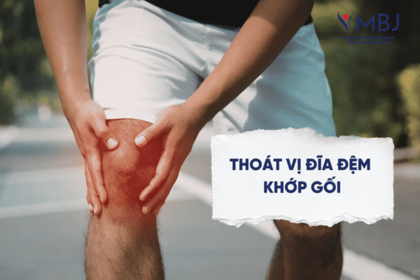 Bệnh lý thoát vị đĩa đệm khớp gối