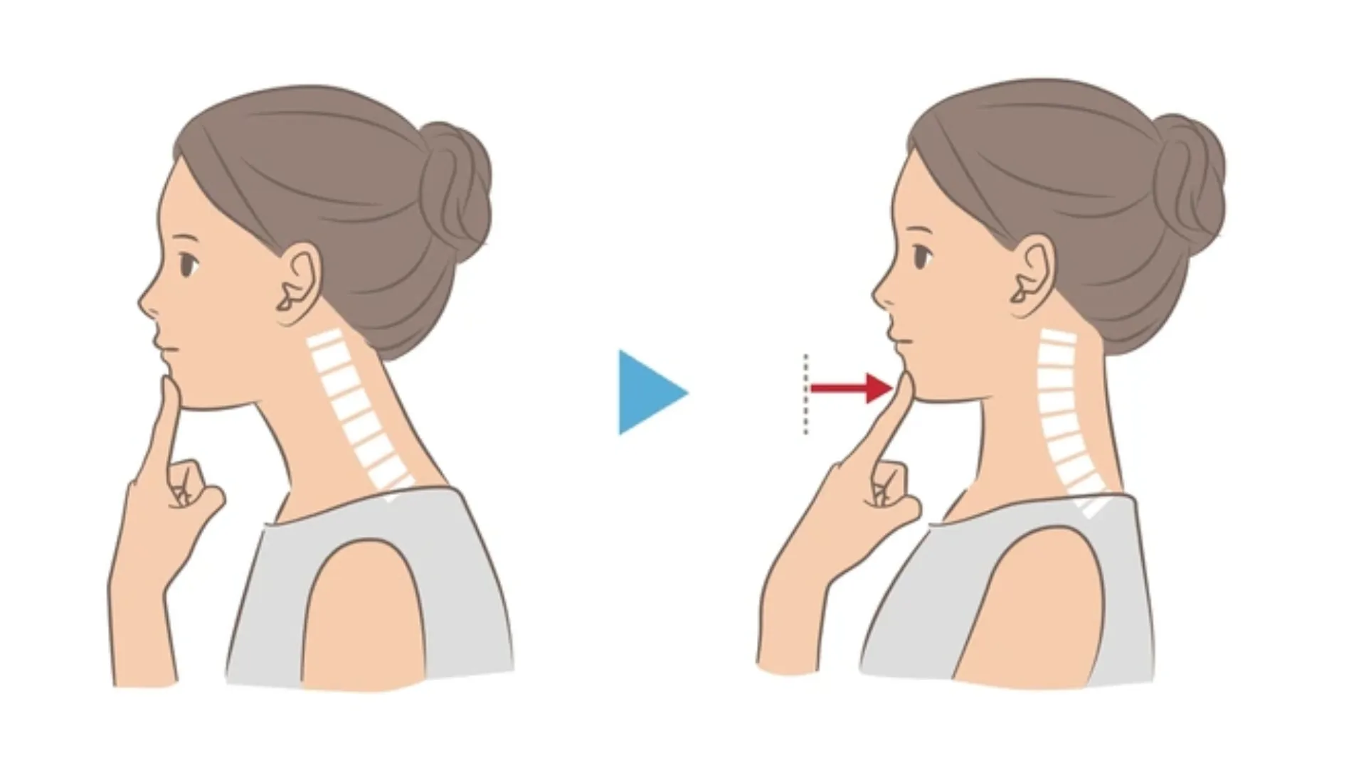 Hướng dẫn thực hiện bài tập Chin Tuck đúng tư thế cho người thoái hóa cột sống cổ: cằm thu về sau, đầu giữ thẳng song song sàn