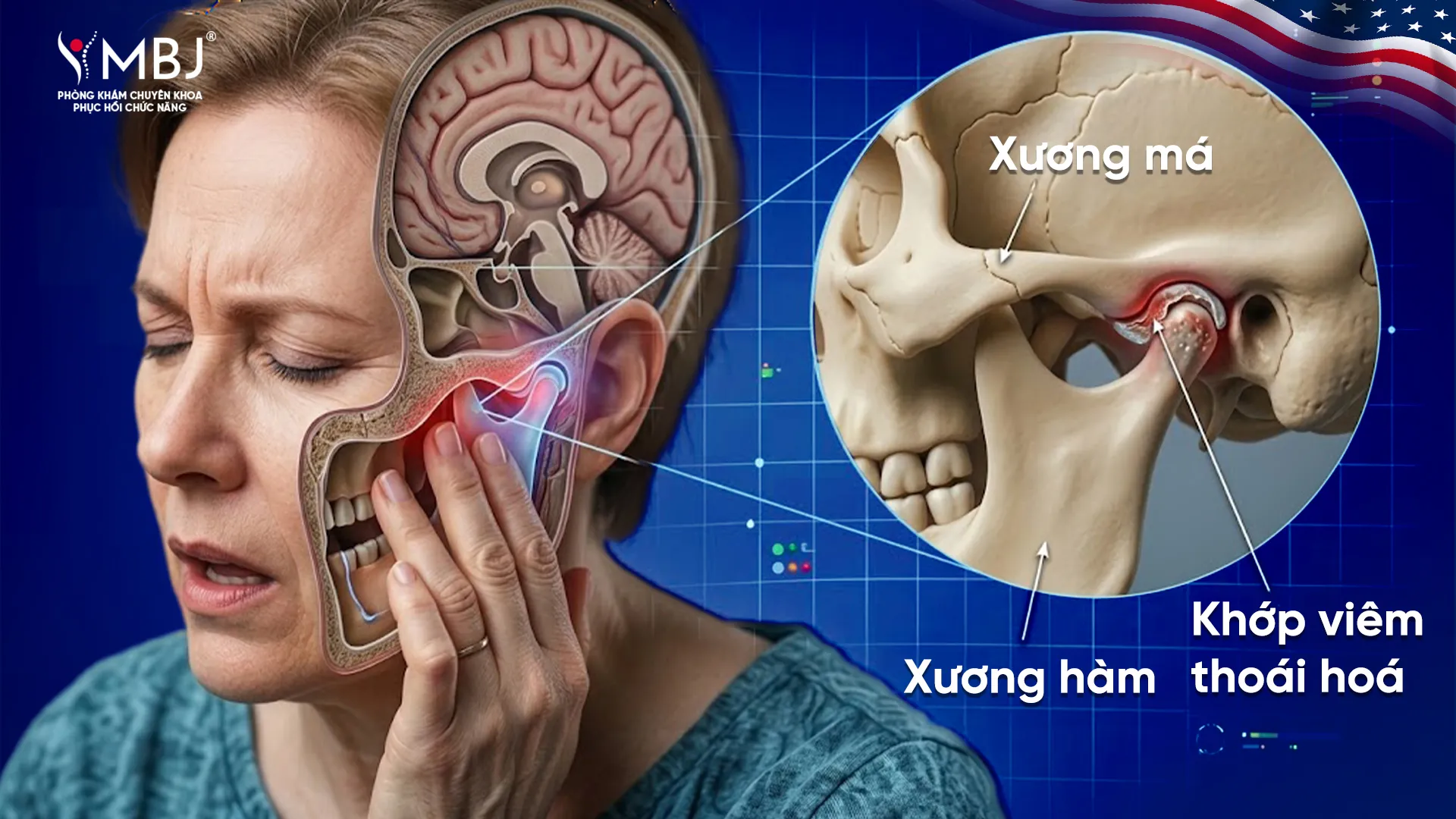 Biến chứng nguy hiểm khi khớp viêm thoái hoá