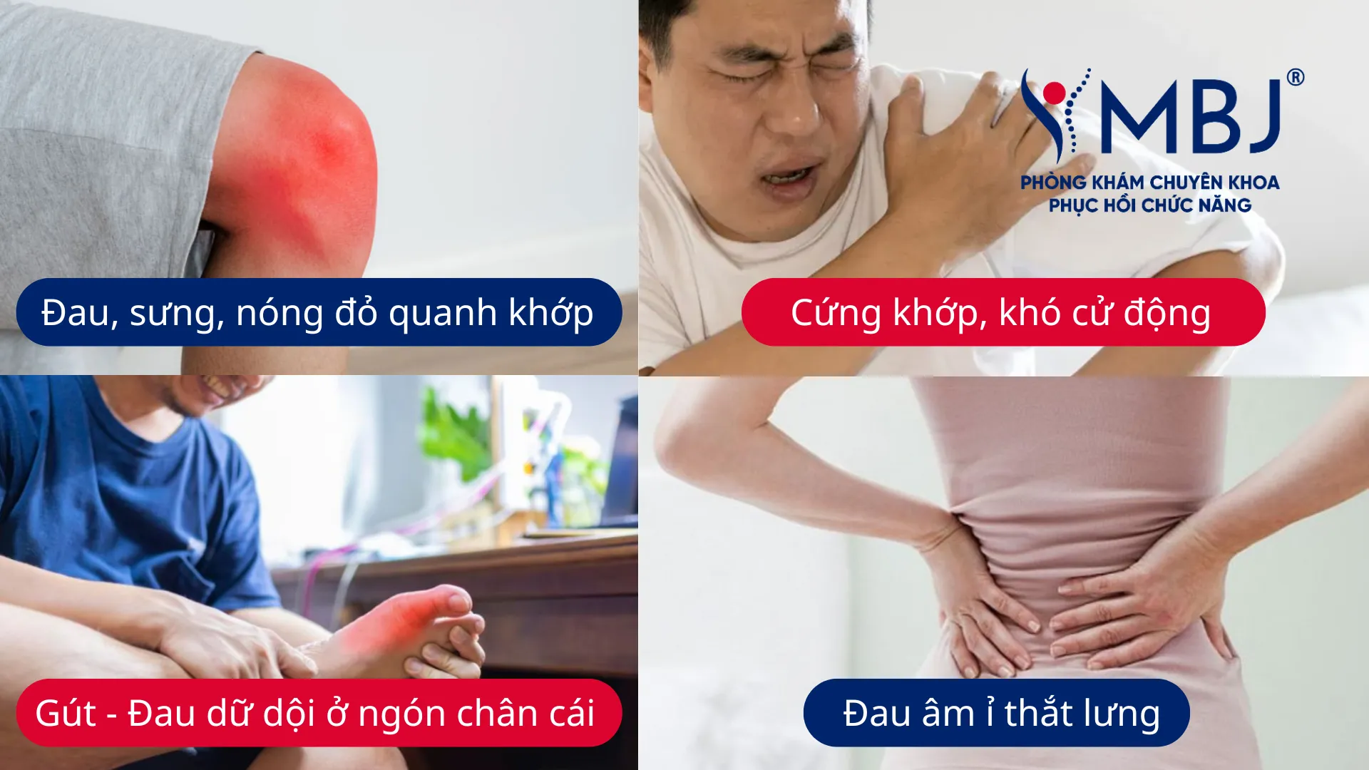 Dấu hiệu của viêm khớp cần lưu ý