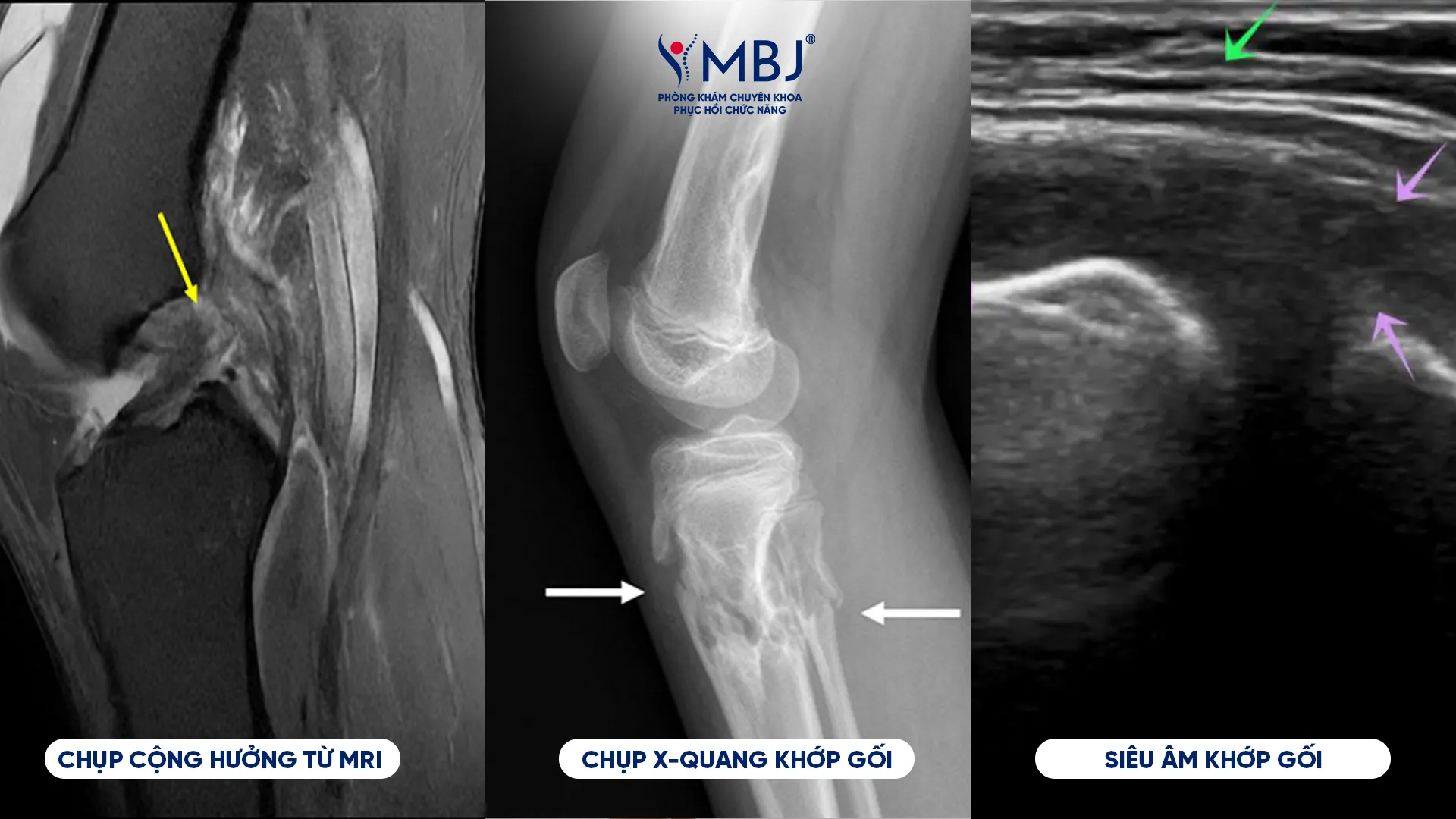 Khi nào cần chụp MRI, siêu âm và X-quang?