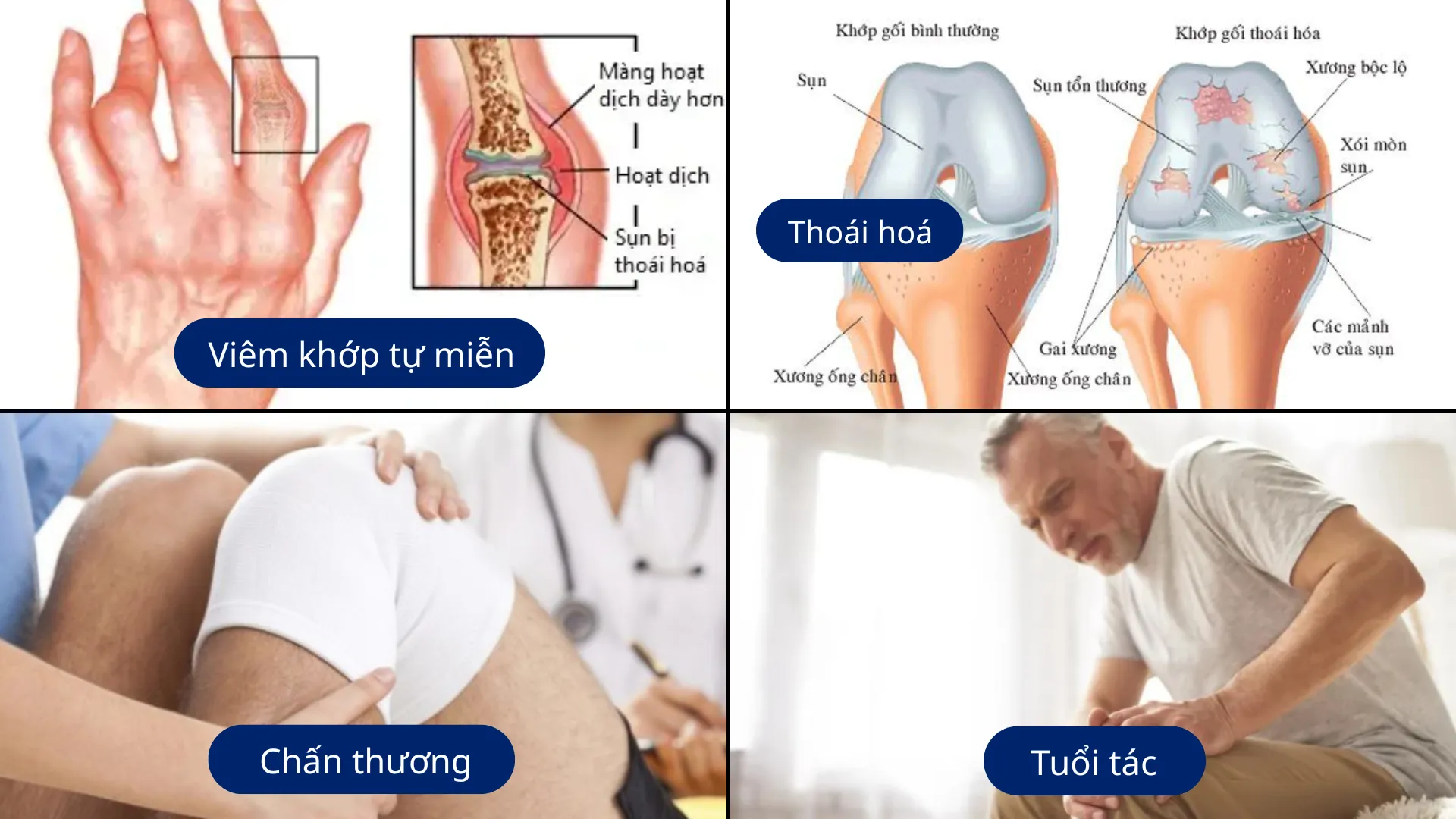 Các nguyên nhân gây ra viêm khớp