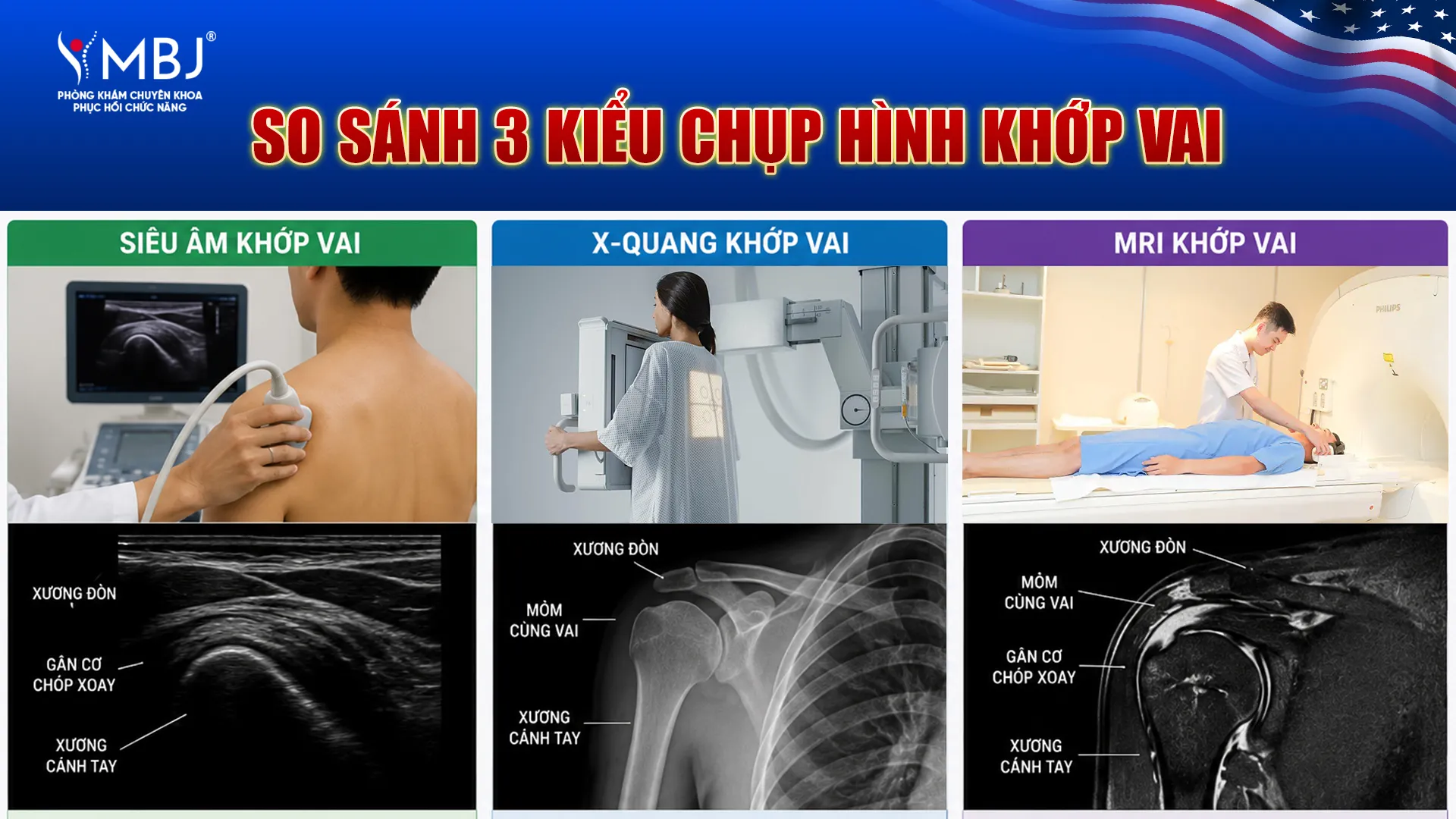 So sánh 2 kiểu chụp hình khớp vai
