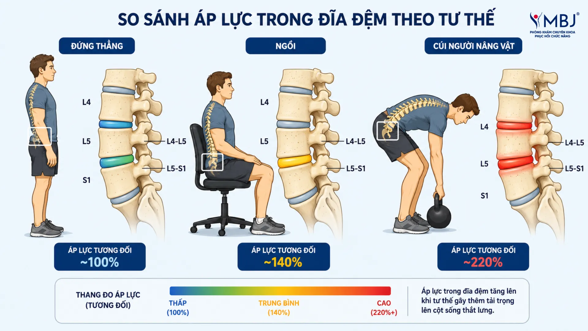 Áp lực nội đĩa đệm tăng khi cúi gập nâng tạ ở người thoát vị đĩa đệm tập gym