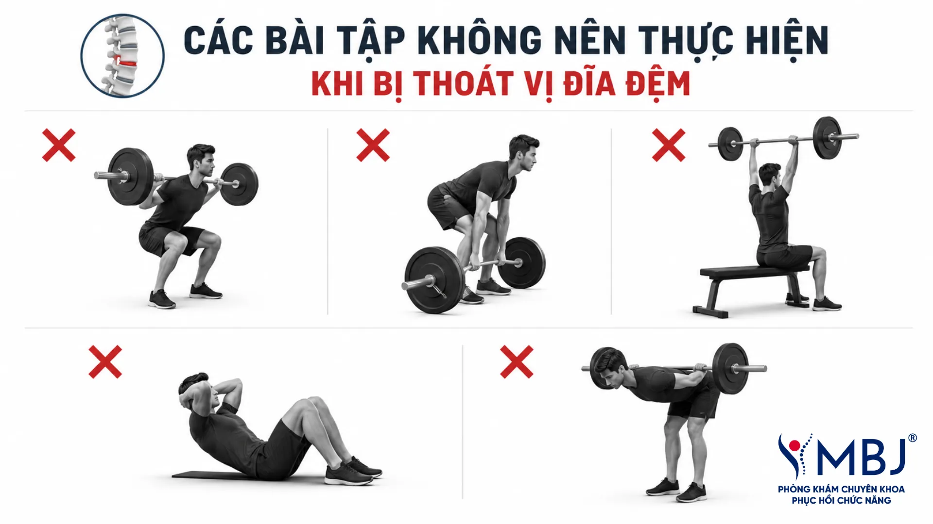 Các động tác gym cần tránh khi bị thoát vị đĩa đệm như squat, deadlift, gập bụng