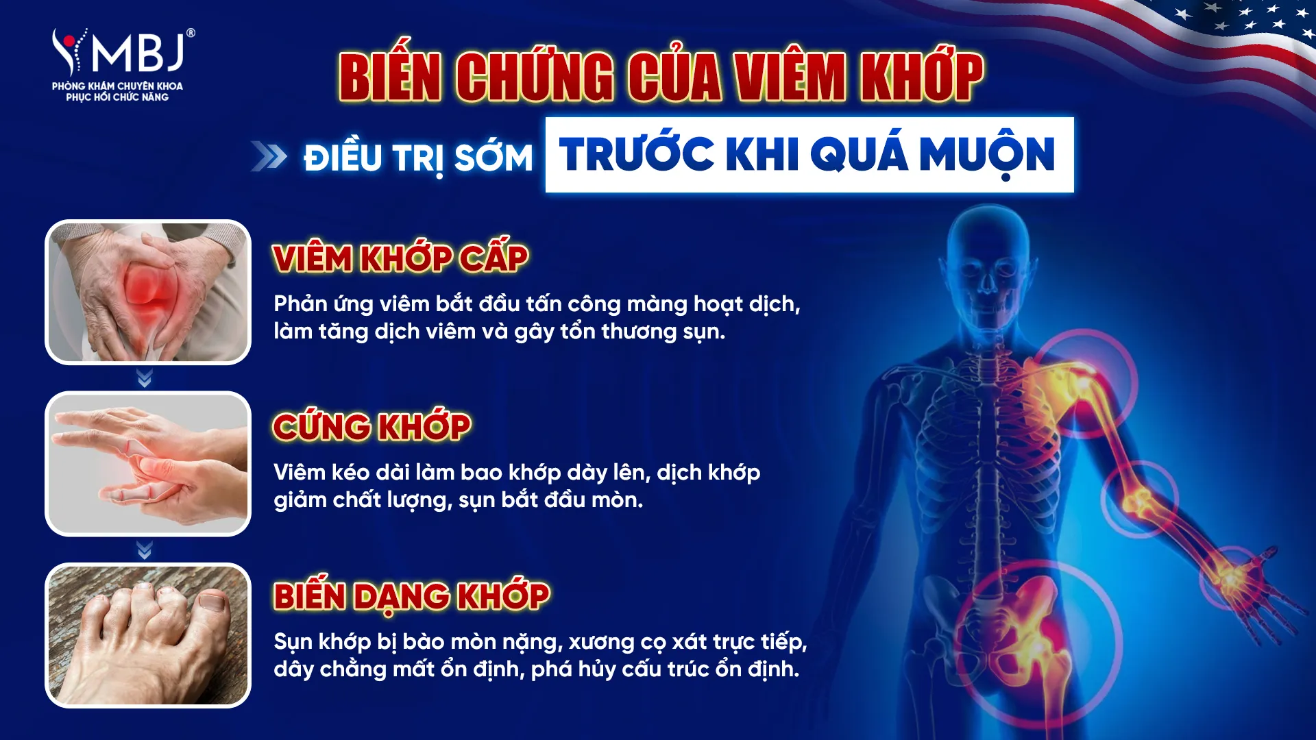 Biến chứng của viêm khớp