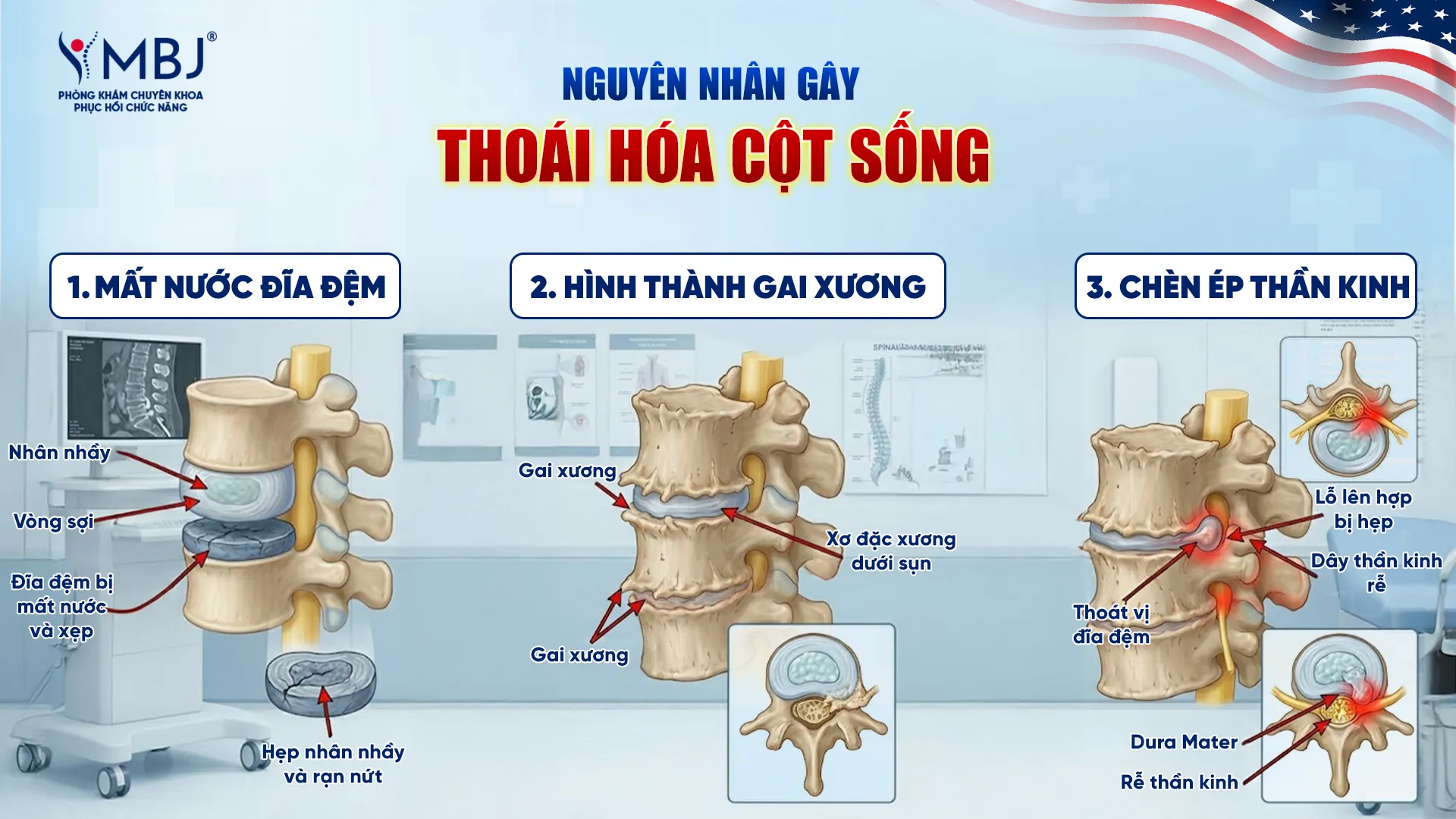 Các nguyên nhân gây thoái hoá cột sống