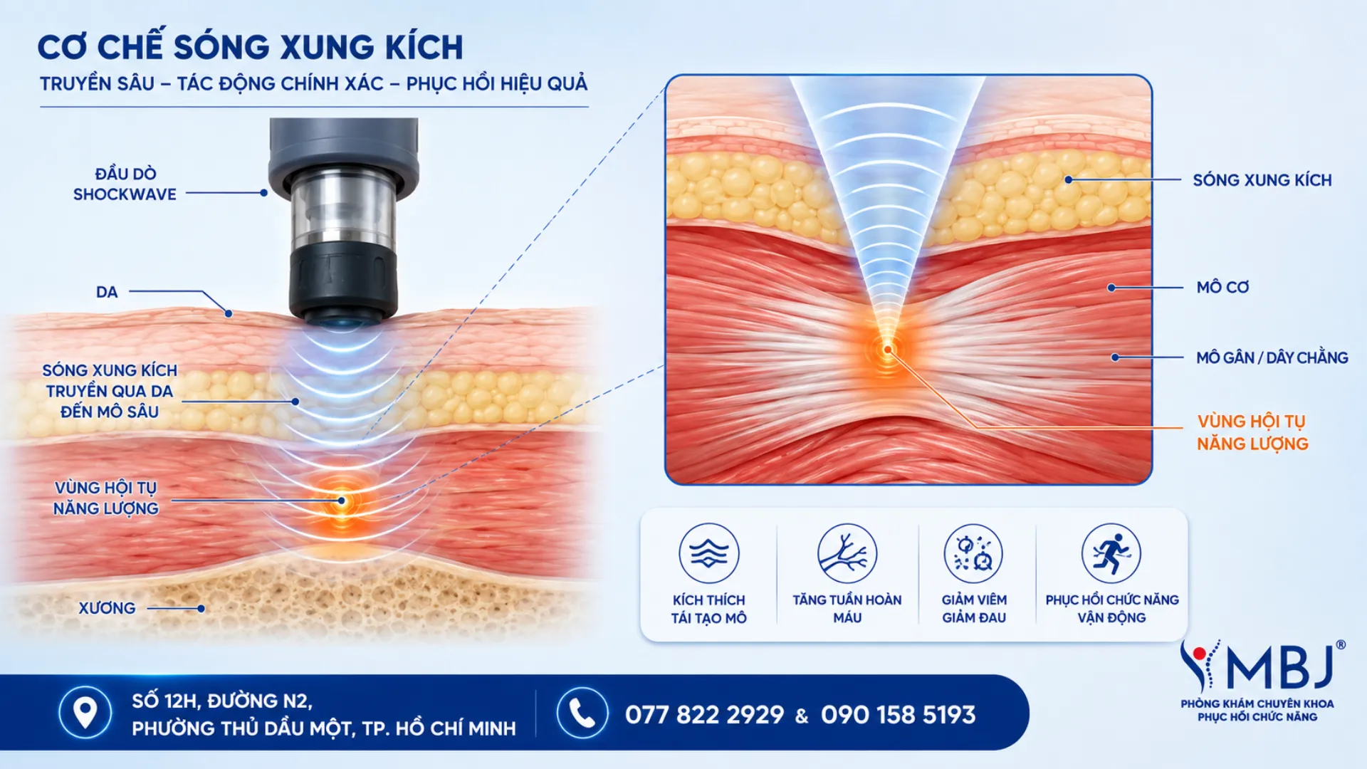 Sơ đồ cơ chế sóng xung kích tác động vào mô gân trong điều trị ESWT