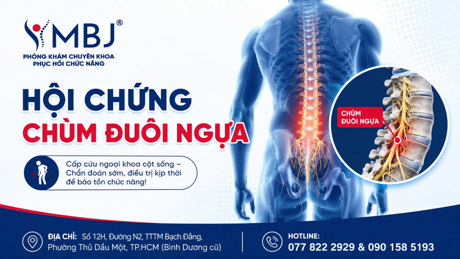 Hội chứng chùm đuôi ngựa