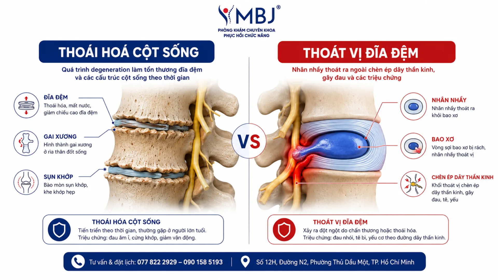 Phân biệt thoái hóa cột sống với thoát vị đĩa đệm