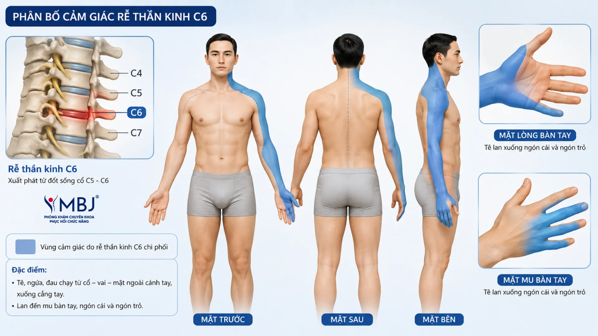 Sơ đồ phân bố cảm giác rễ thần kinh C6