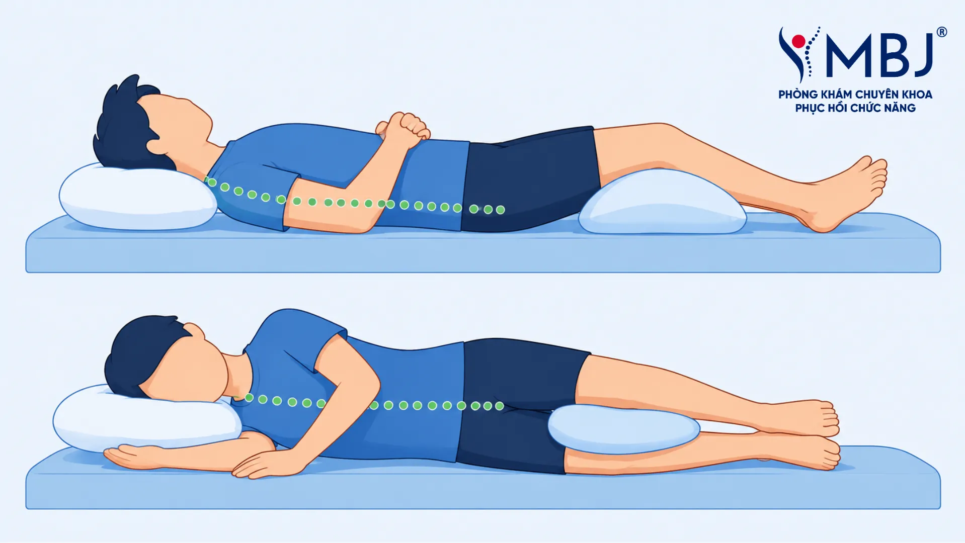 Tư thế nằm ngửa kê gối và nằm nghiêng kẹp gối cho người thoát vị đĩa đệm