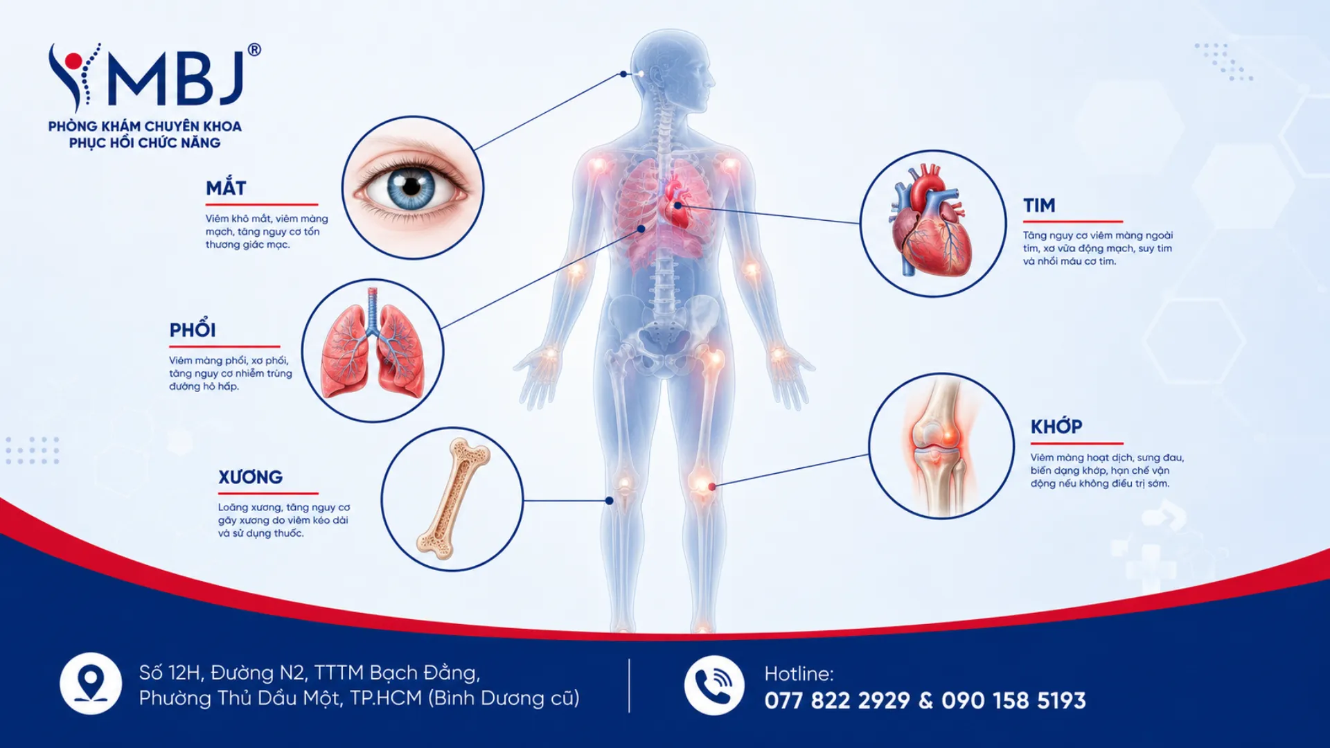 Sơ đồ cơ thể thể hiện tim, phổi, mắt bị ảnh hưởng bởi biến chứng viêm khớp dạng thấp