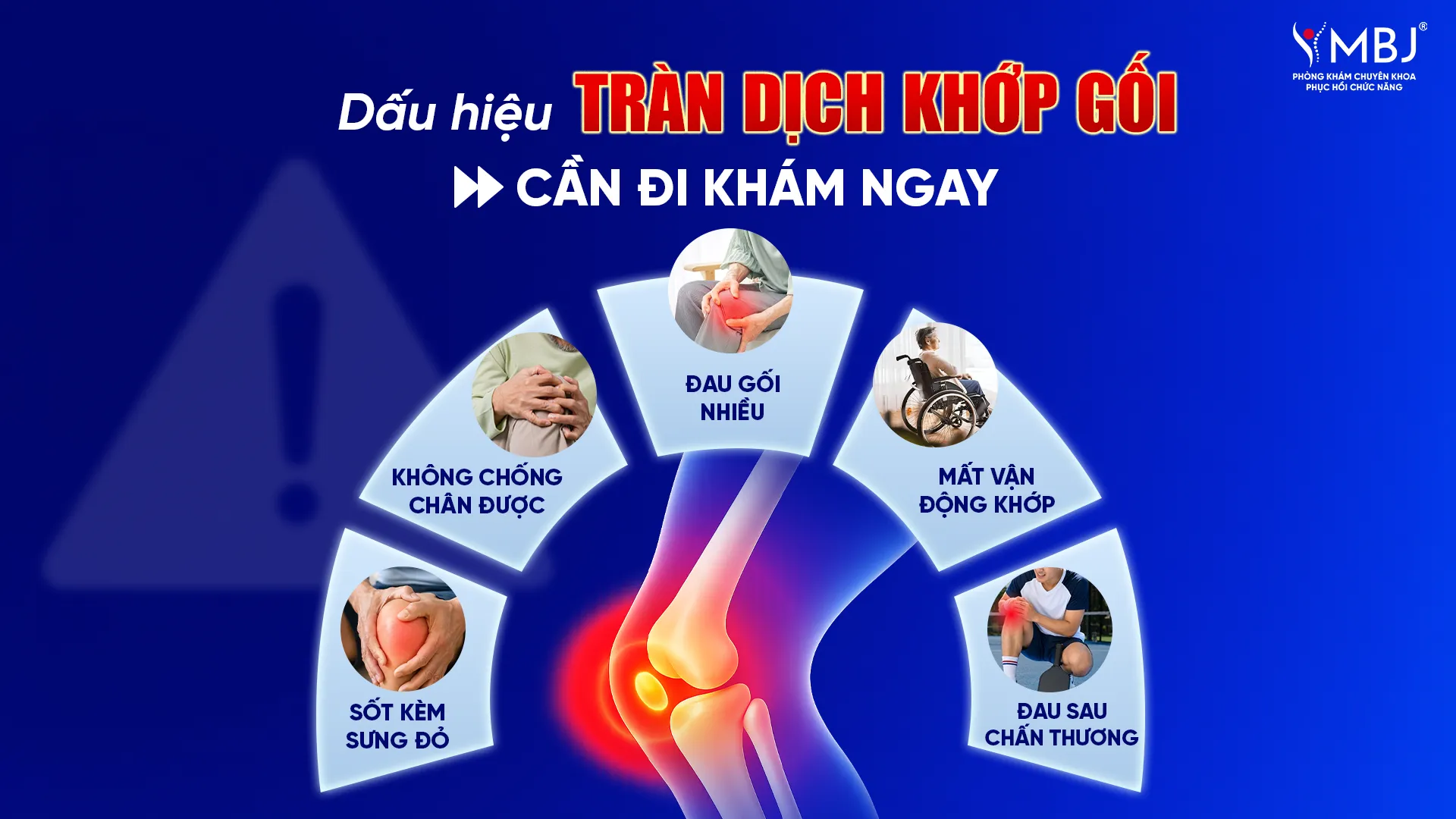 Triệu chứng tràn dịch khớp gối cần đi khám ngay