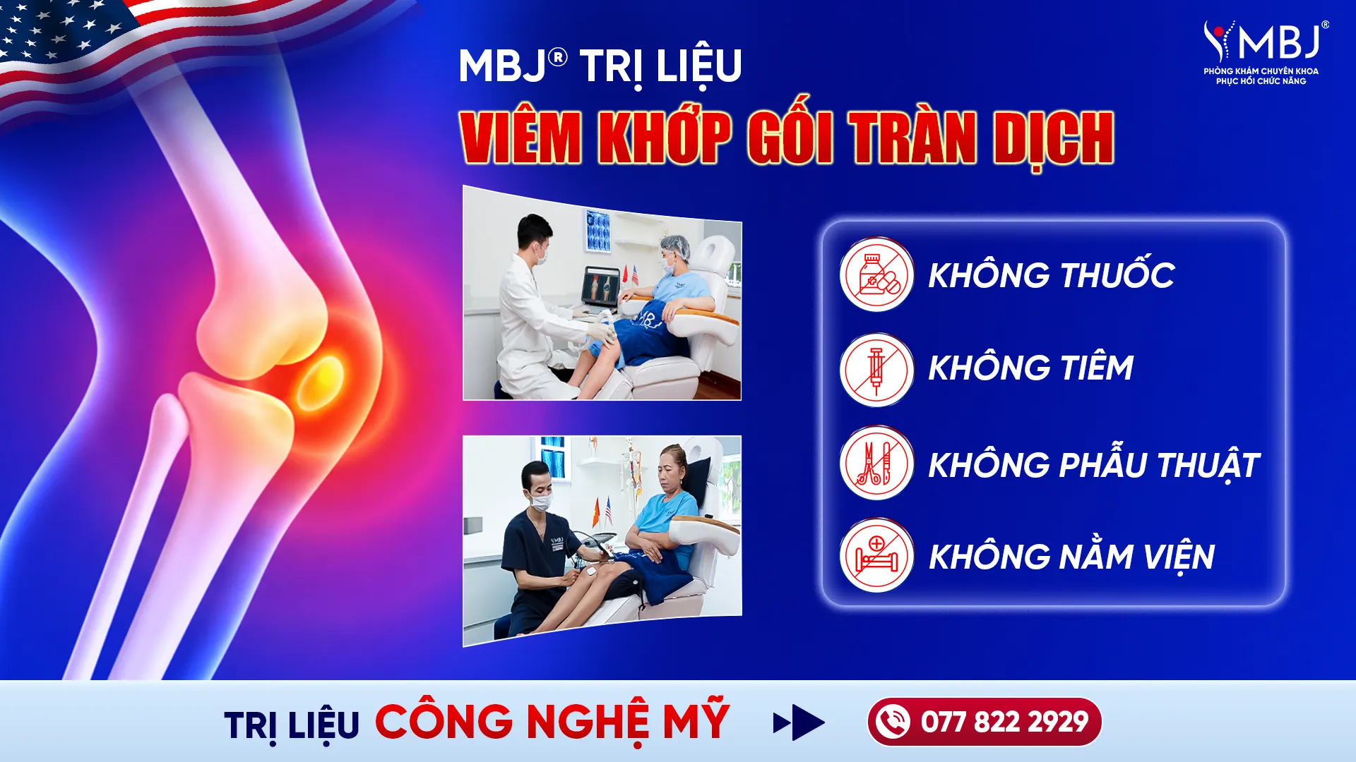 MBJ điều trị viêm khớp gối tràn dịch bằng công nghệ cao