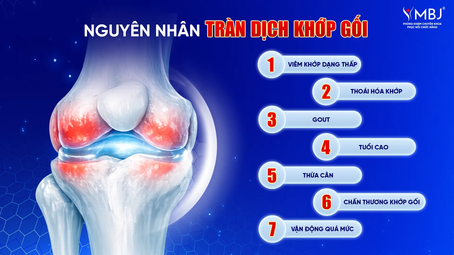 Nguyên nhân tràn dịch khớp gối là gì?