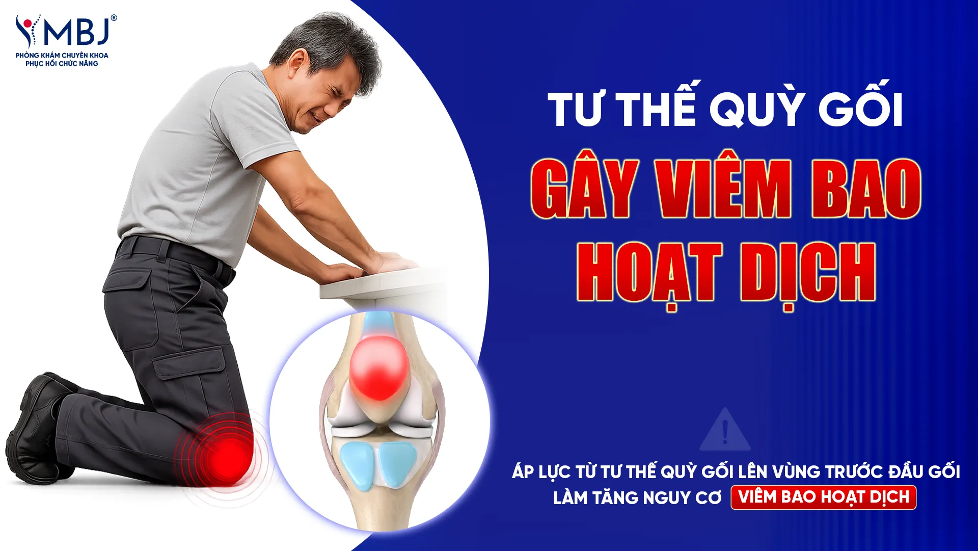 Tư thế gây viêm bao hoạt dịch khớp gối
