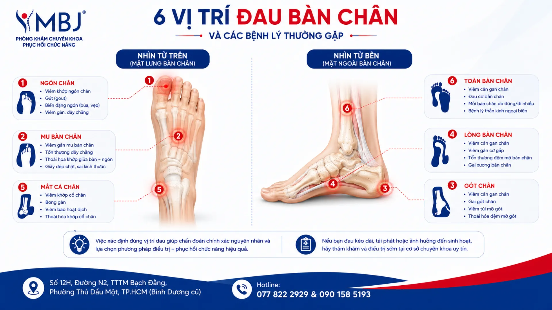 Các vị trí đau thường gặp trên bàn chân