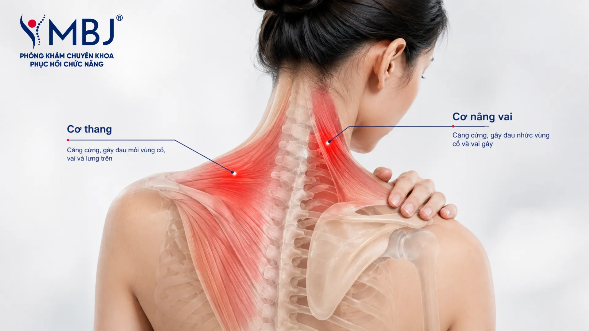 Vùng cơ thang và cơ nâng vai co cứng gây đau cổ vai gáy