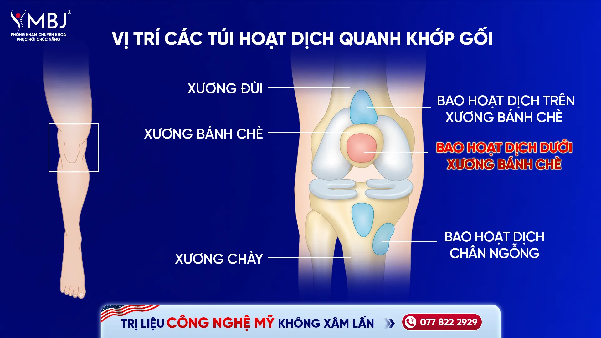 Vị trí túi hoạt dịch khớp gối