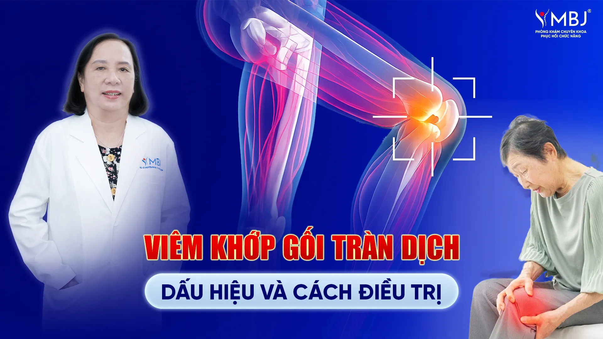 Viêm khớp gối tràn dịch là gì? Cách điều trị như thế nào?