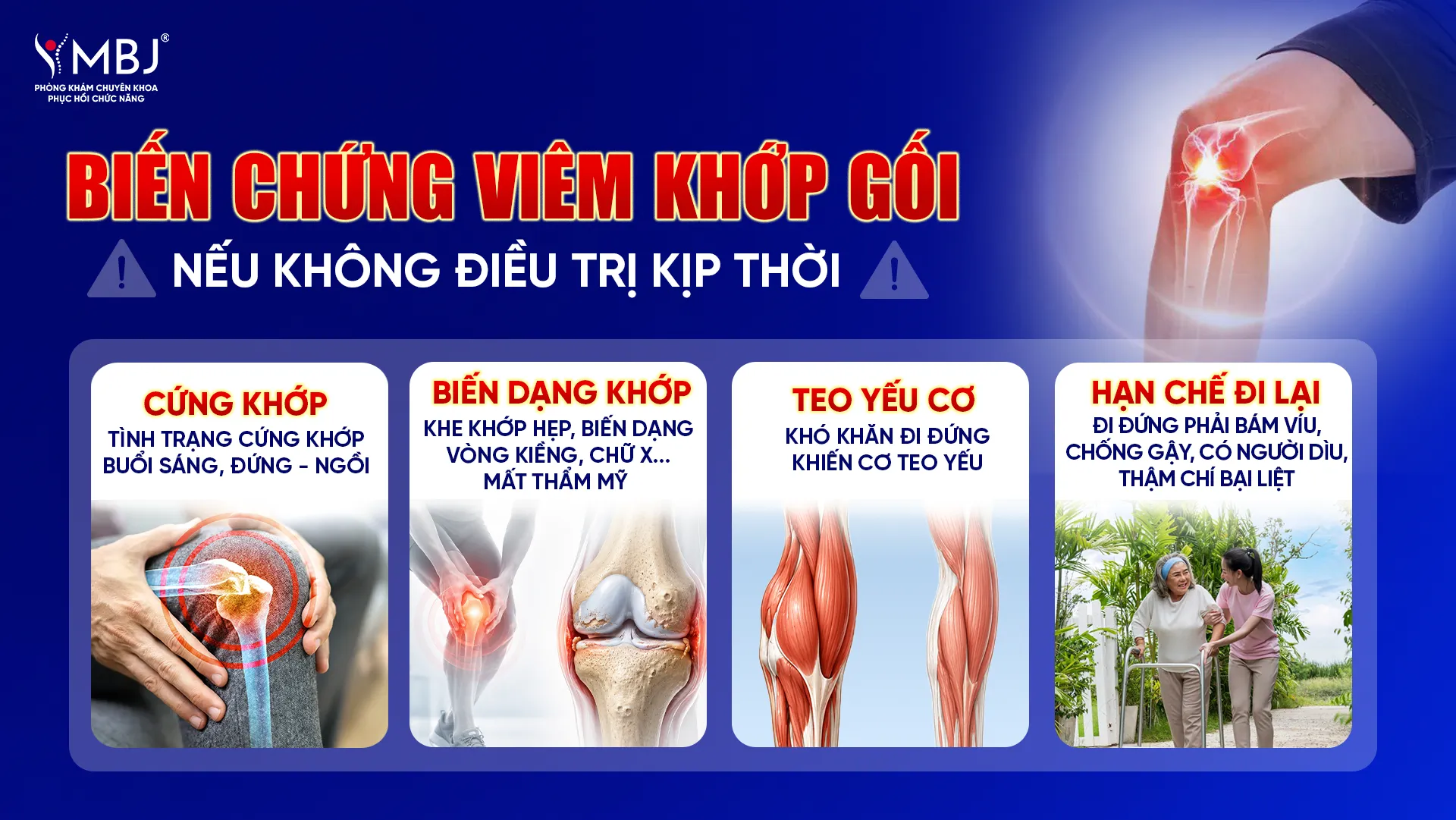 Biến chứng viêm khớp gối nếu không điều trị kịp thời