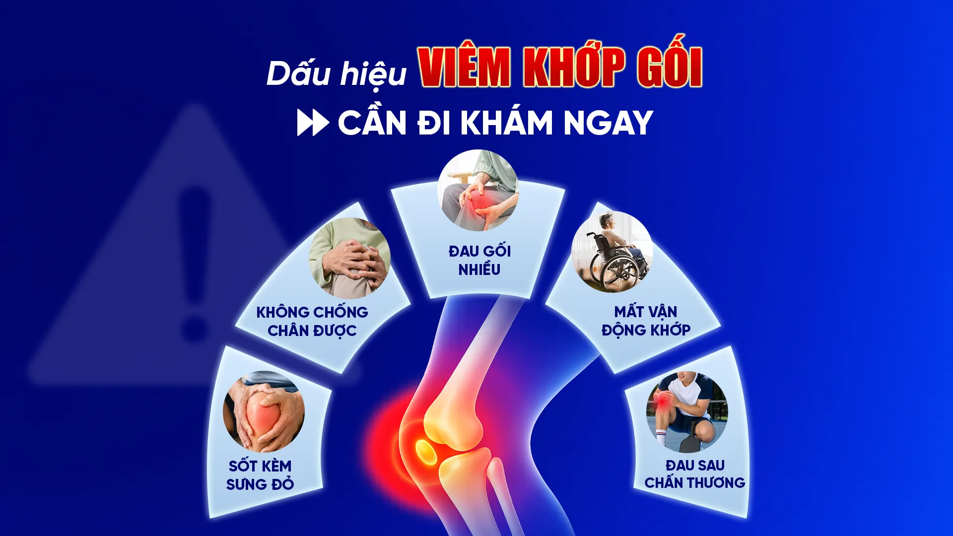 Dấu hiệu viêm khớp gối cần đi khám ngay