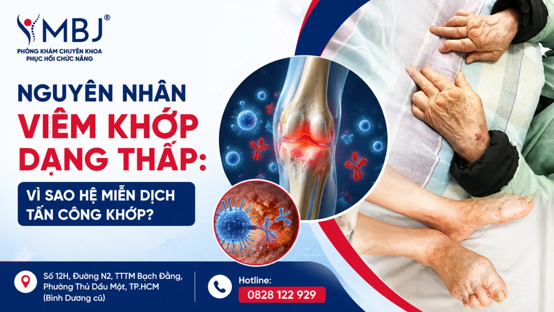 Nguyên nhân viêm khớp dạng thấp và 7 yếu tố nguy cơ chính của bệnh tự miễn
