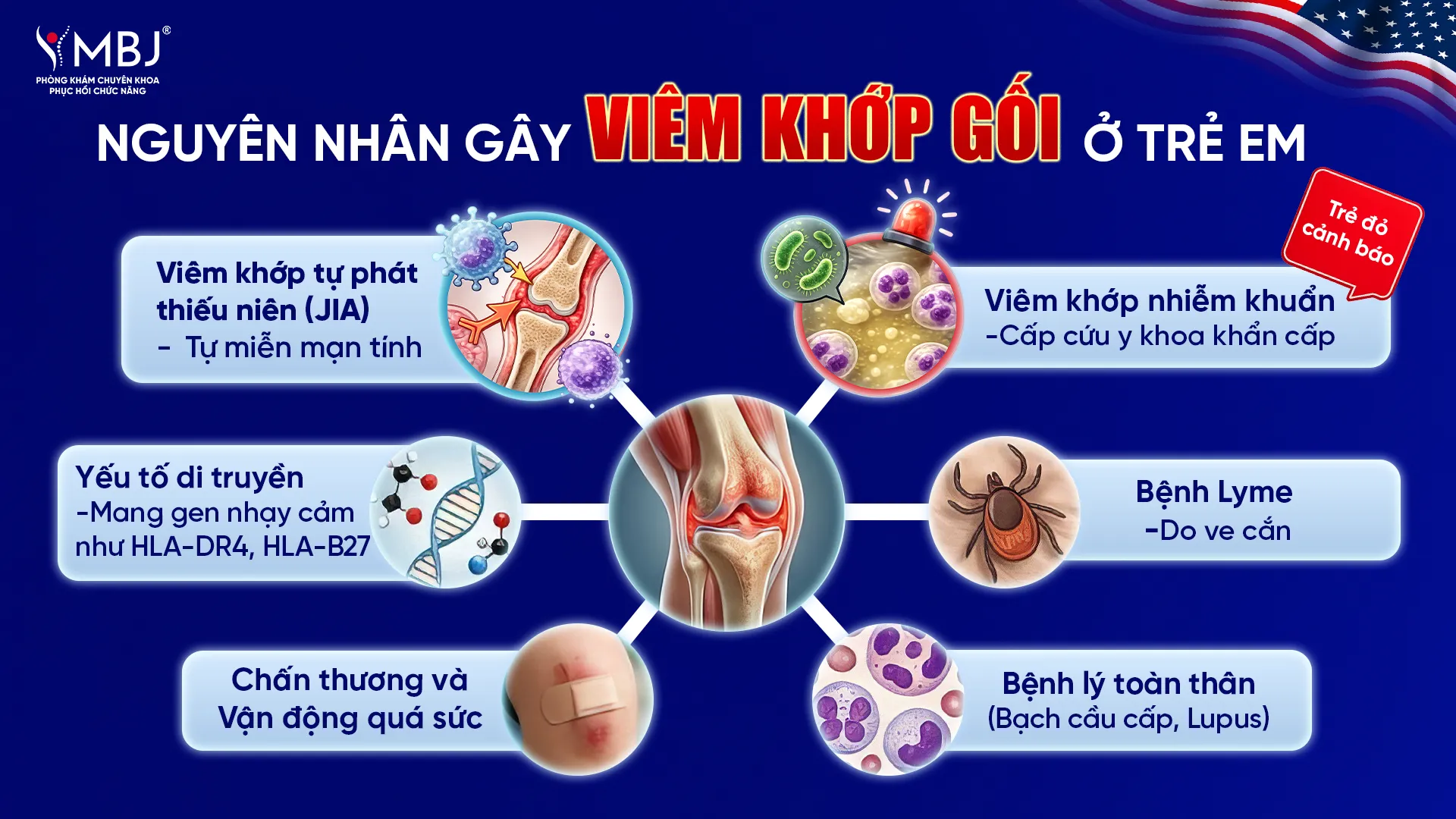 Sơ đồ các nguyên nhân viêm khớp gối ở trẻ