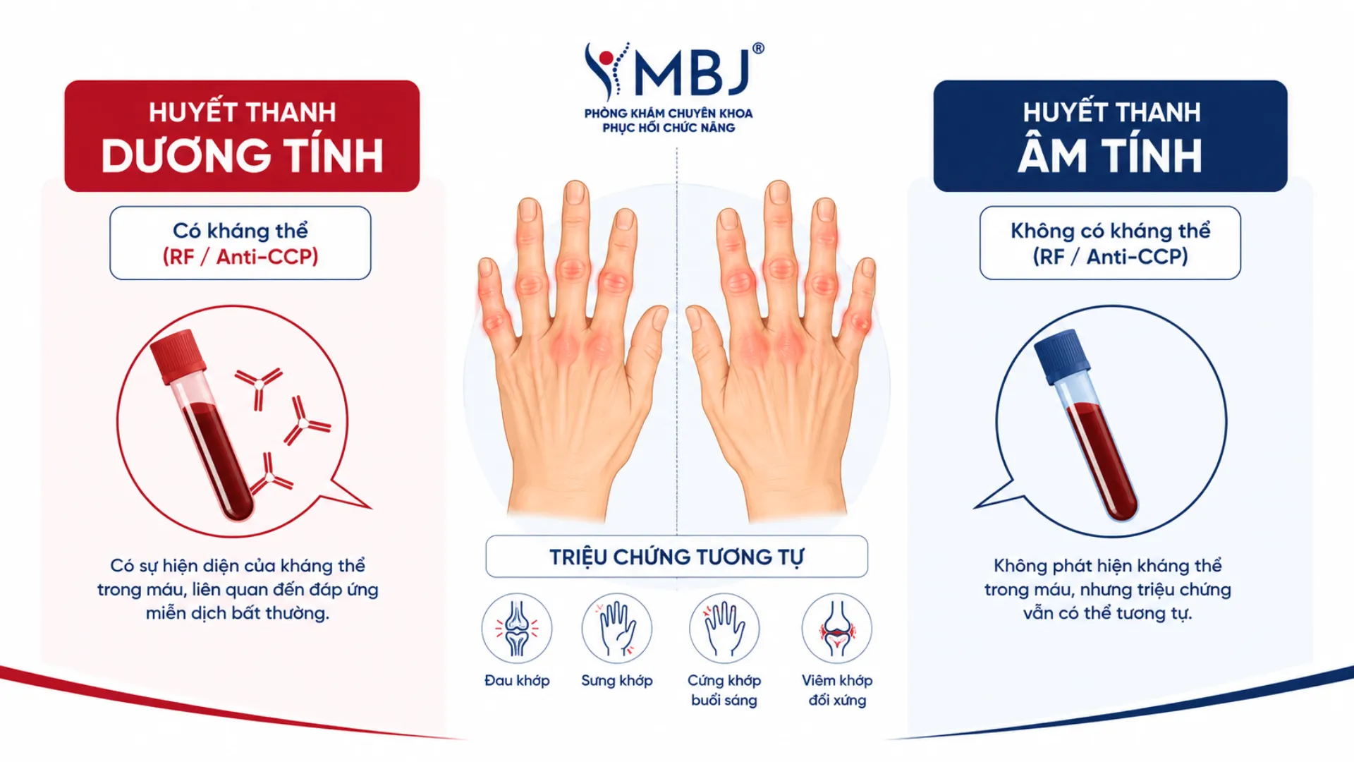 So sánh hai thể viêm khớp dạng thấp huyết thanh dương tính và âm tính theo kháng thể và tiên lượng