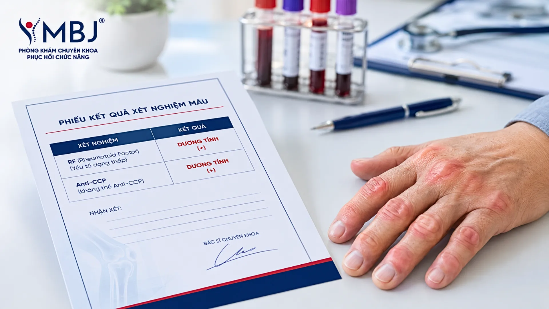 Phiếu xét nghiệm máu tìm yếu tố dạng thấp RF và kháng thể anti-CCP đặt cạnh bàn tay sưng khớp